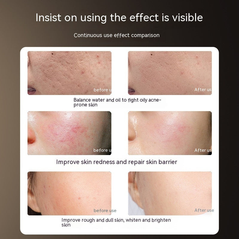 Photon LED IPL Beauty Mask – Home Phototherapy for Skin Rejuvenation