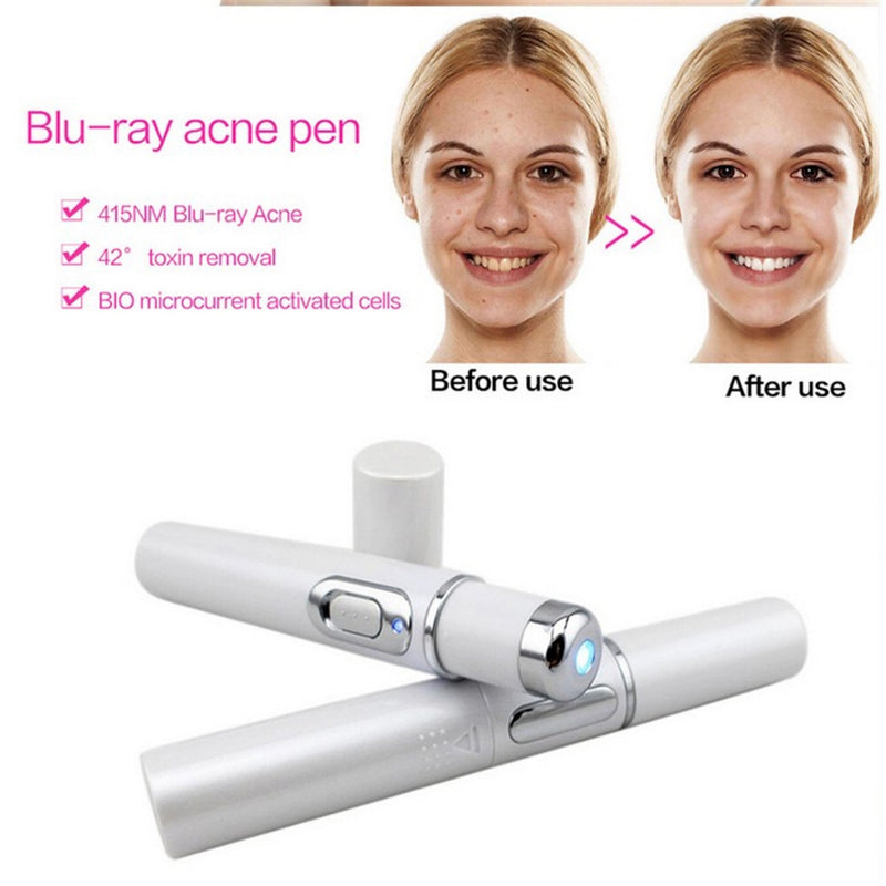 Blue Light Acne Laser Pen – Scar & Wrinkle Treatment