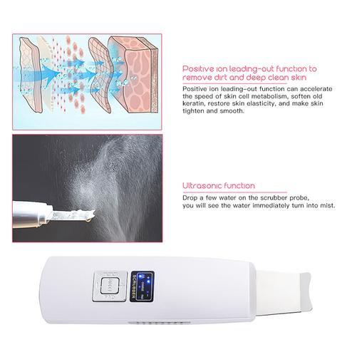 Ultrasonic Skin Scrubber & Facial Cleanser – Blackhead, Acne Remover & Spa Vibration Massager