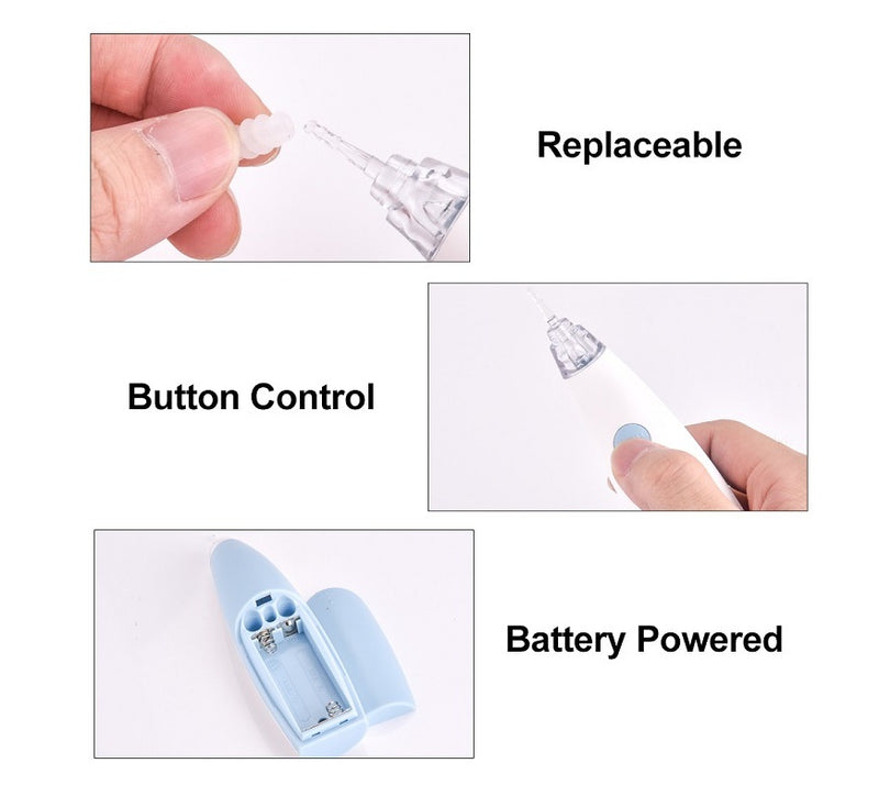 Smart Ear Wax Remover – Rotating Vacuum Cleaner