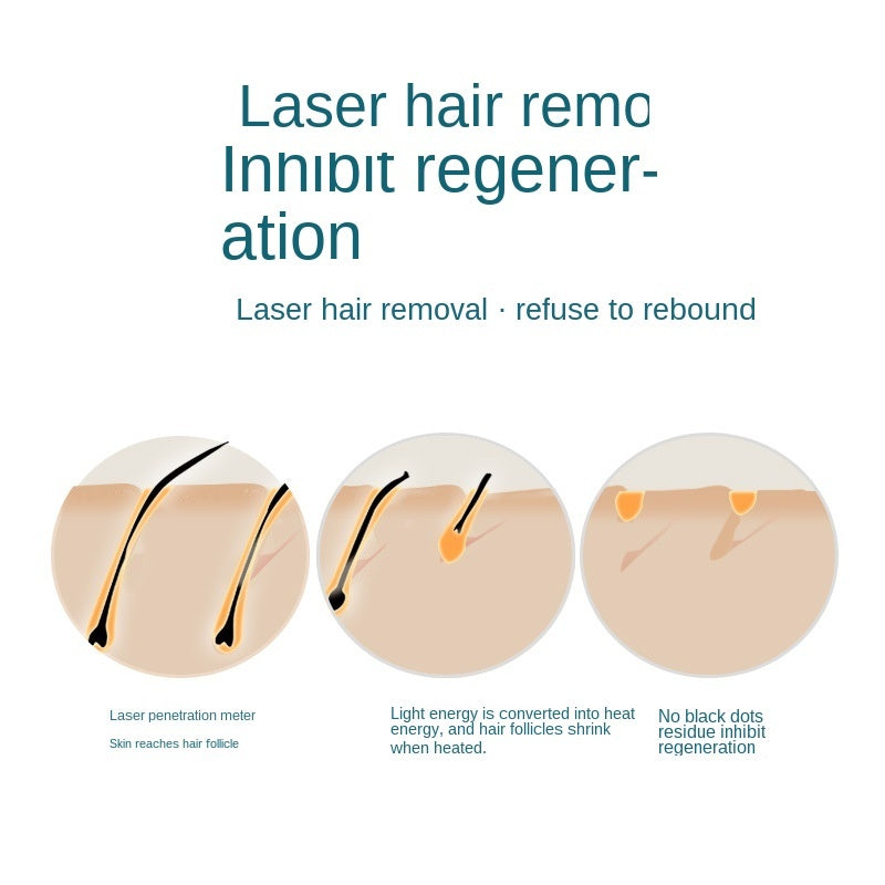 Mini IPL Laser Hair Remover – 990,000 Shots, Permanent Whole Body Epilator