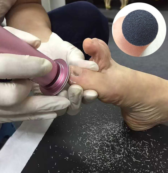 Electric Callus Remover – Rechargeable Foot File for Smooth Heels