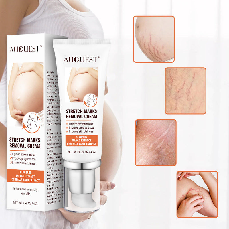 Stretch Marks Removal Cream – Firming, Anti-Aging, and Skin Rejuvenation Treatment