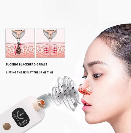 Blackhead Suction Pro – Deep Cleansing Pore Vacuum