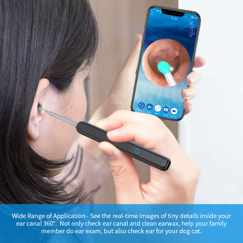 Digital Ear Wax Remover – Wireless LED Otoscope Kit
