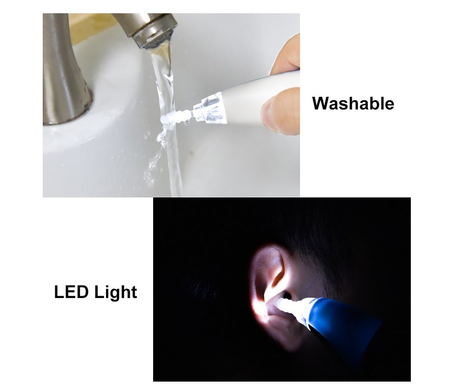 Smart Ear Wax Remover – Rotating Vacuum Cleaner