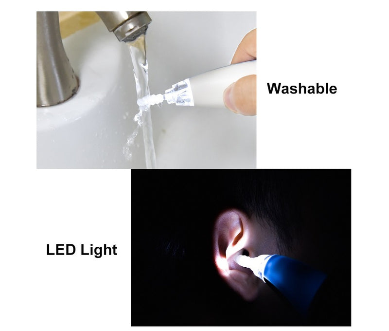 Smart Ear Wax Remover – Rotating Vacuum Cleaner