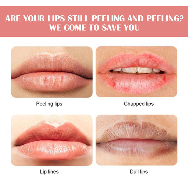 Watermelon Freeze-Dry Hydrating Lip Balm
