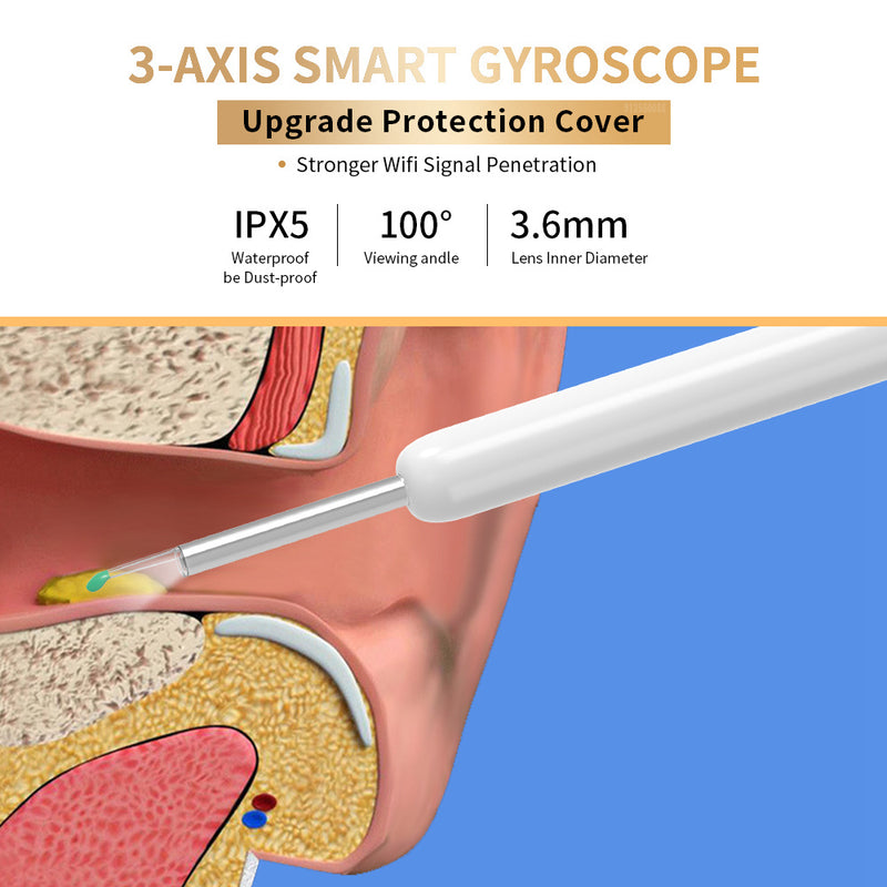 Digital Ear Wax Remover – Wireless LED Otoscope Kit