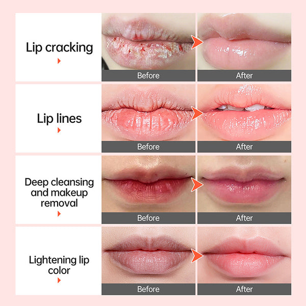 Anti-Chap Nourishing Lip Balm