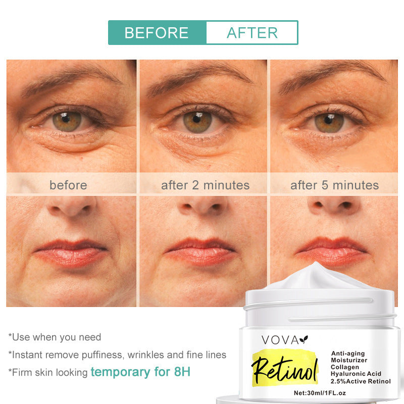 Revitalift Retinol Face Cream – Advanced Anti-Aging Moisturizer