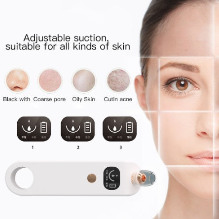 Blackhead Suction Pro – Deep Cleansing Pore Vacuum