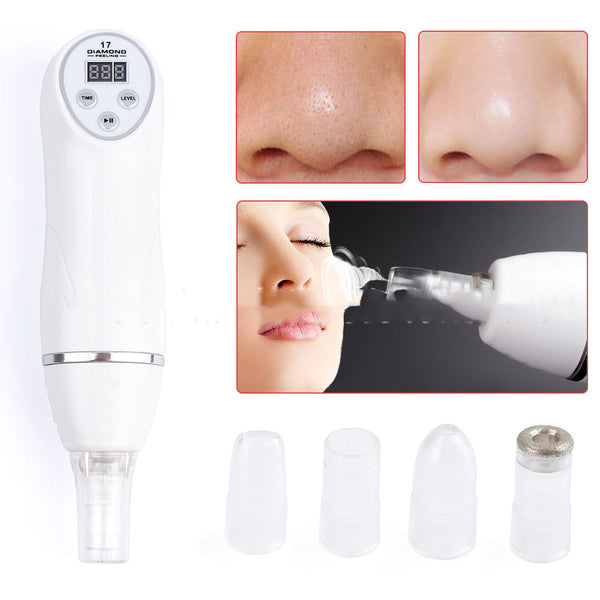 Electric Pore Vacuum & Acne Remover – Professional Beauty Cleaner