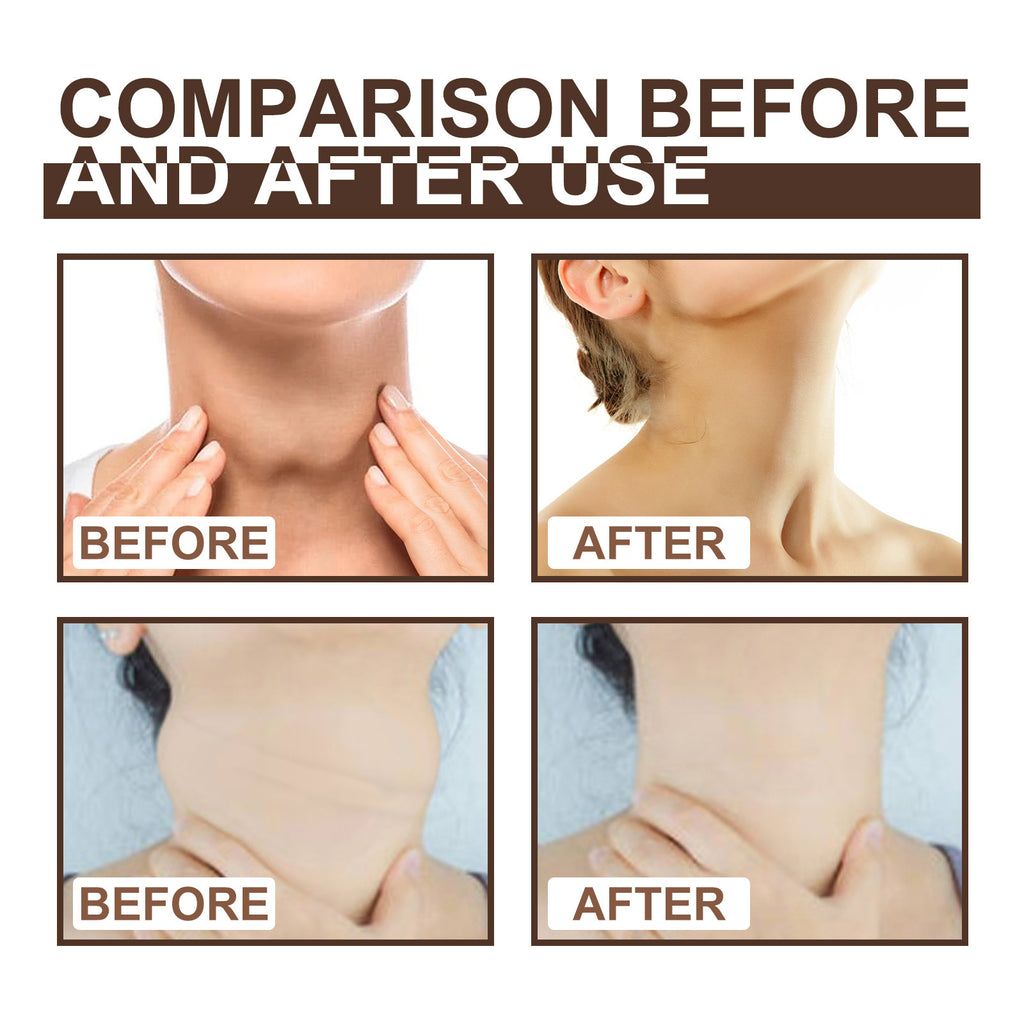 Thyroid & Lymph Repair Health Ointment