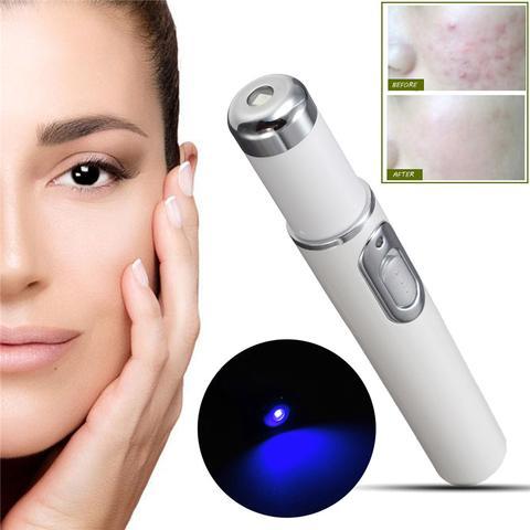 Blue Light Acne Laser Pen – Scar & Wrinkle Treatment