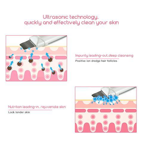 Ultrasonic Skin Scrubber & Facial Cleanser – Blackhead, Acne Remover & Spa Vibration Massager