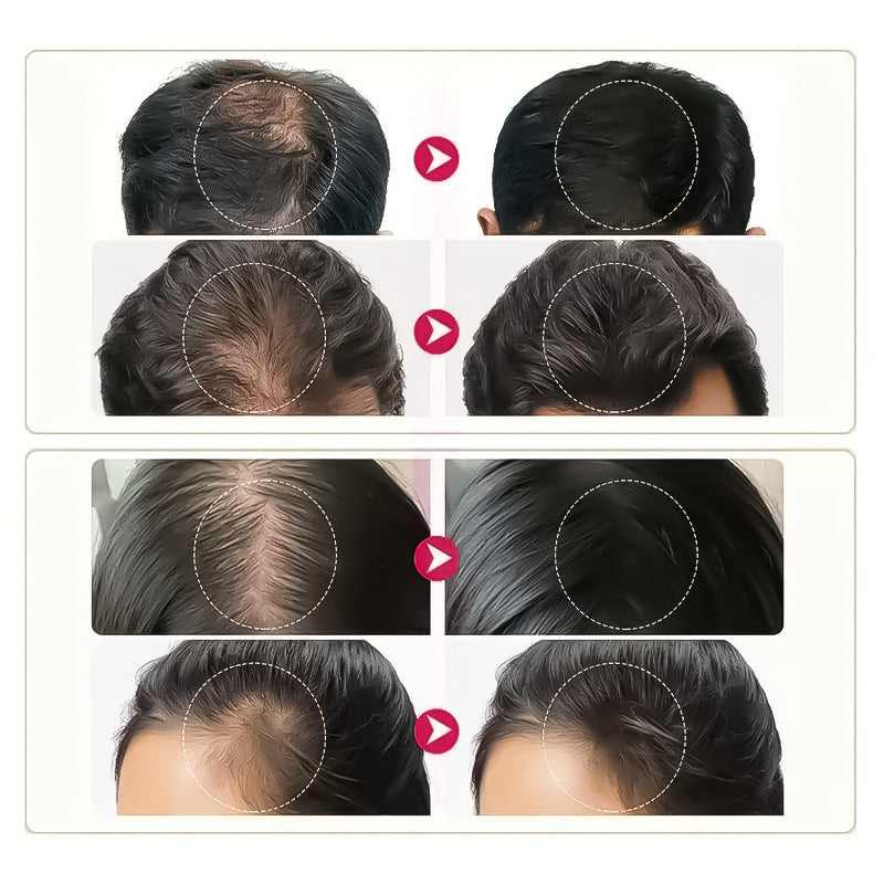 Biotin & Collagen Hair Growth Oil – Strength & Volume