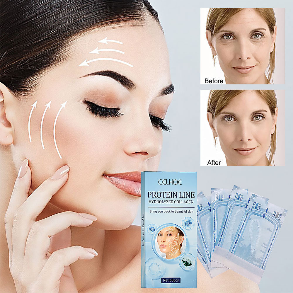 Protein Lifting Line – Anti-Wrinkle & Fine Line Treatment