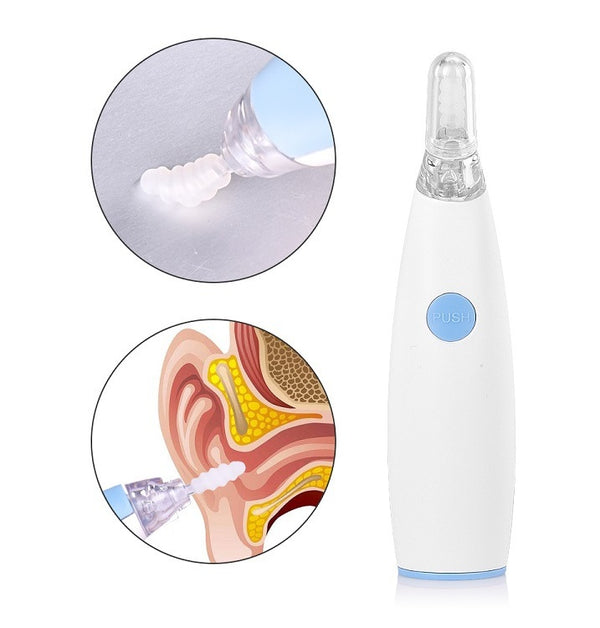 Smart Ear Wax Remover – Rotating Vacuum Cleaner