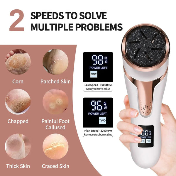 Electronic Foot Files Portable Foot Callus Remover