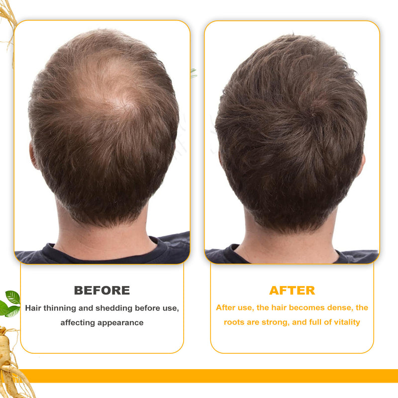 Biotin Dense Hair Series Deep Cleaning