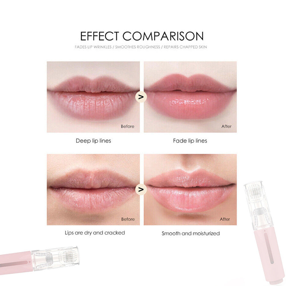 VibeLuxe Lip Care – High-Frequency Lip Massager