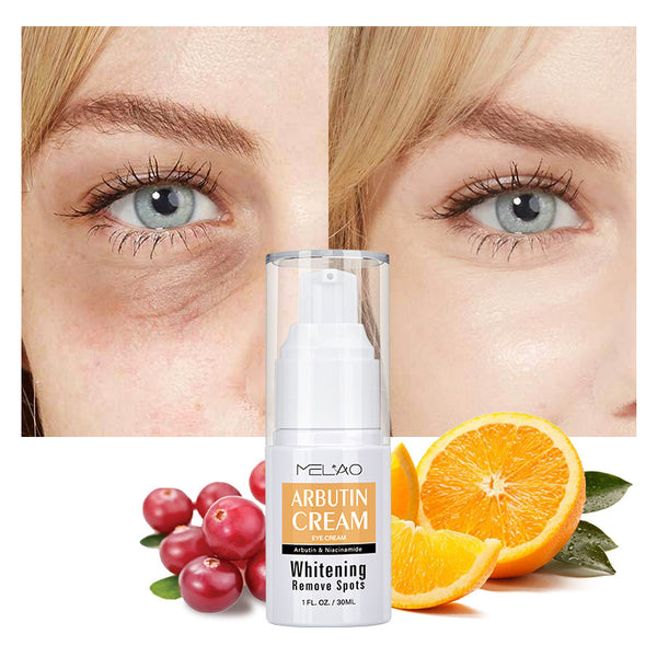 Arbutin Eye Cream – Brightening & Soothing Solution for Eye Bags