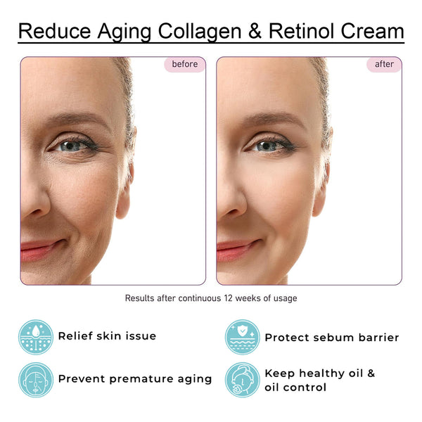 Reduce Aging Collagen & Retinol Face Cream