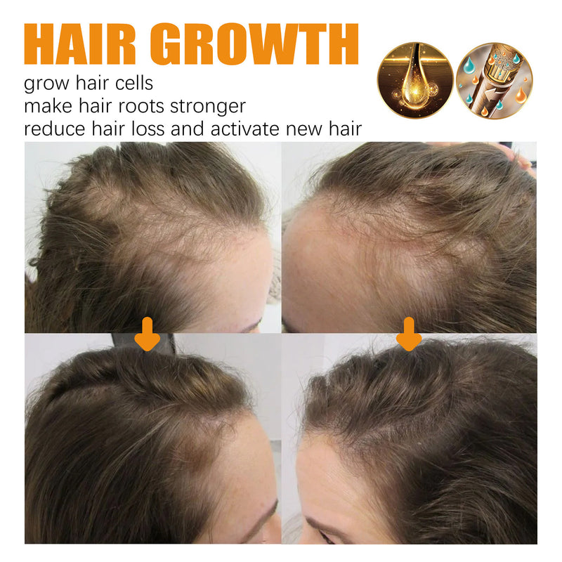 Biotin Dense Hair Series Deep Cleaning