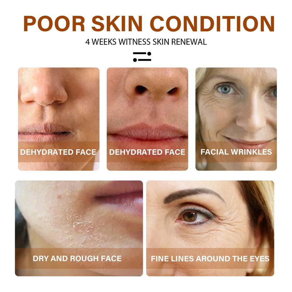 AgeRenew Radiance – Lifting & Hydration Complex