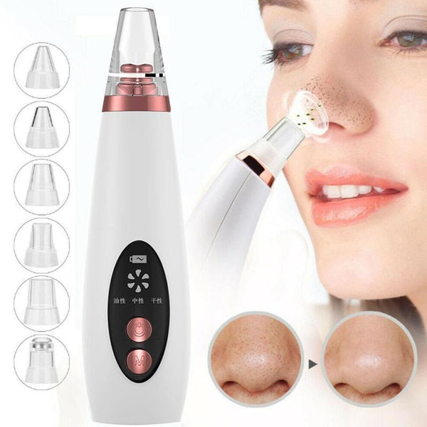 PorePerfect – Blackhead Removal & Nose Cleanser Device