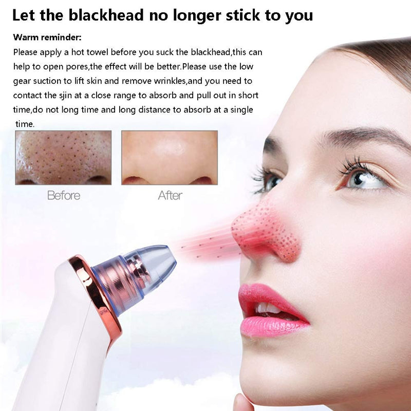 Multifunctional Pore Vacuum & Blackhead Remover