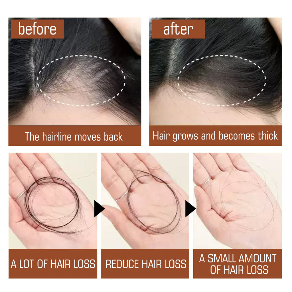 Pure Batana Oil Hair Treatment – Strengthen, Smooth & Prevent Hair Loss
