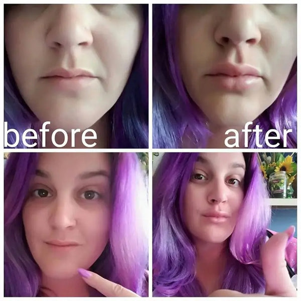 Lip Boost Pro - Automatisches Lippenvergrößerungsgerät
