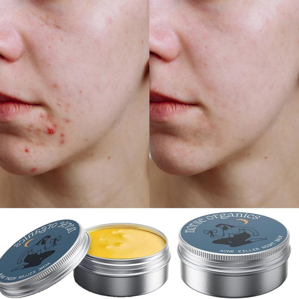 Multi-Action Repair Cream – Acne & Skin Relief