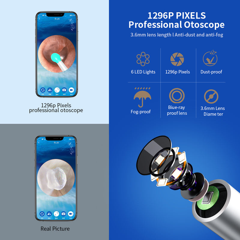 Digital Ear Wax Remover – Wireless LED Otoscope Kit